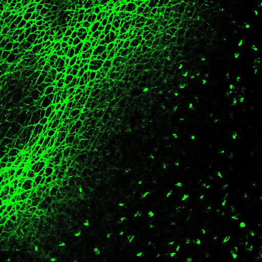 Two-photon image of fresh rat peritoneal muscle tissue after FITC-dextran injection, with a bright green branching network against a dark background.