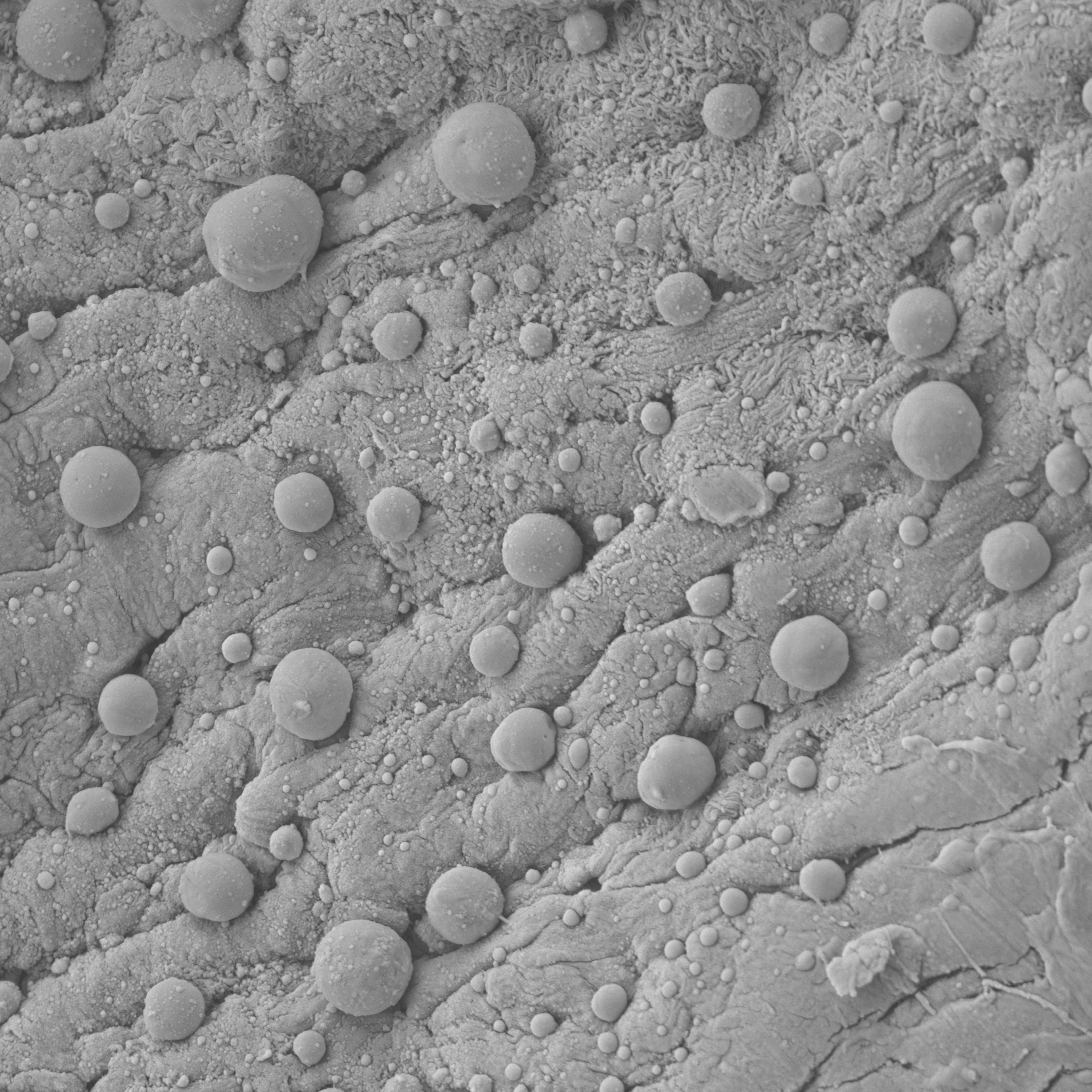 SEM image of mouse peritoneal wall mesothelium after TMS processing, showing textured surfaces and rounded protrusions.