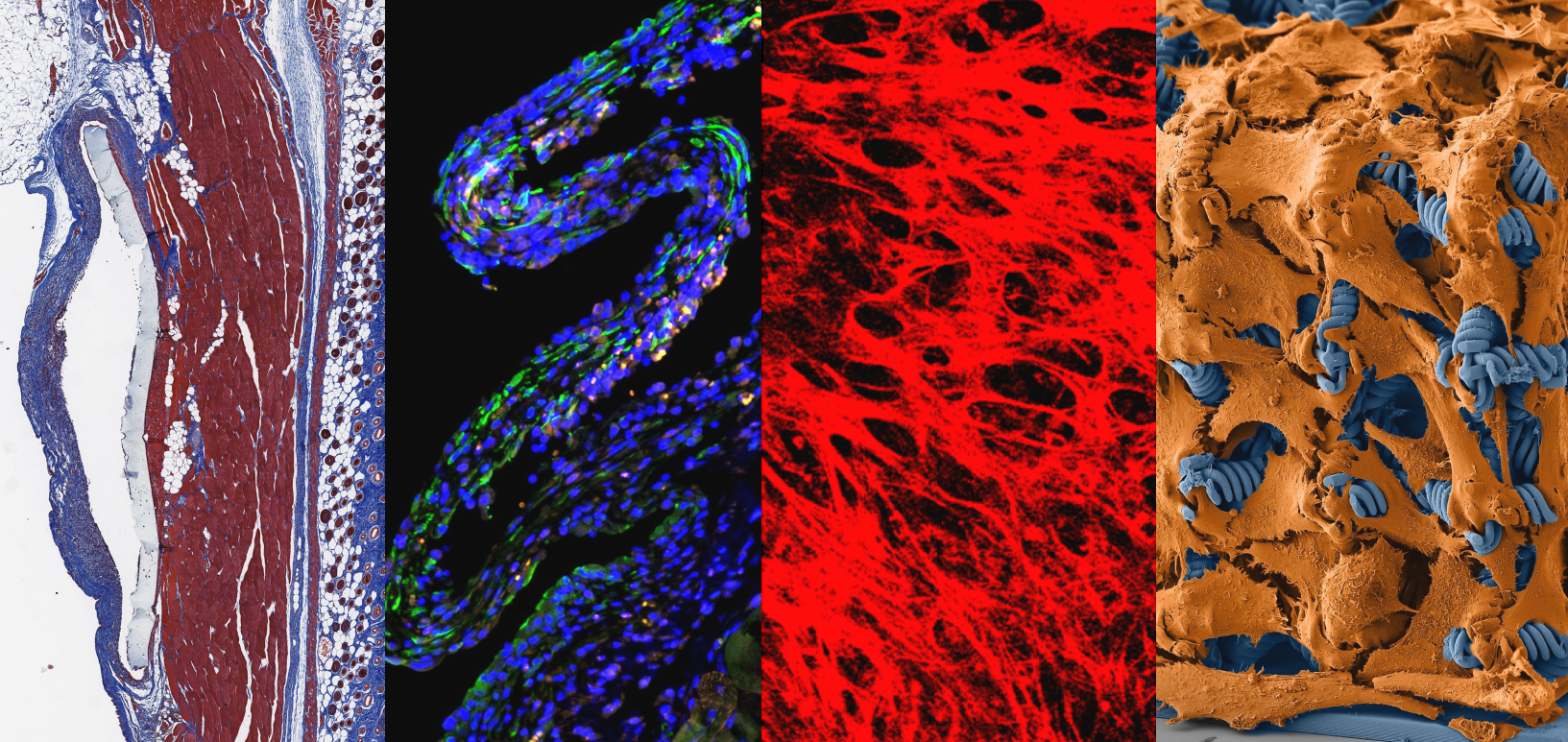 Four-panel collage of tissue sections, fluorescence microscopy, and an orange-and-blue woven scaffold.