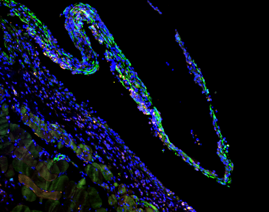 Mouse fibrotic tissue with DAPI in blue, α-SMA (AF488) in green, and CD45 (AF594) in orange.